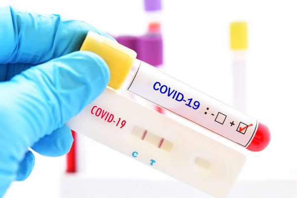 коронавірус, експрес-тести, носівчанин