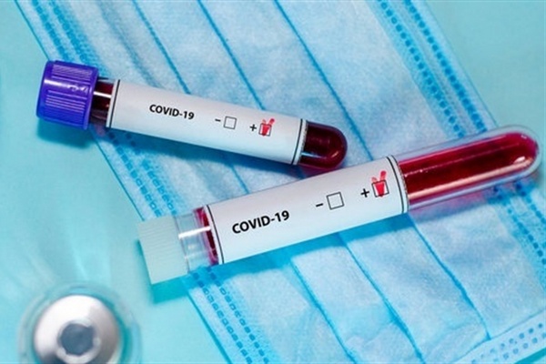 коронавірус, ніжинка, ПЛР-тест