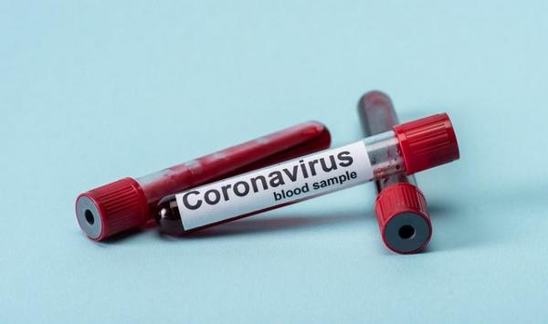 коронавірус, Ніжин, хворі, лікарня