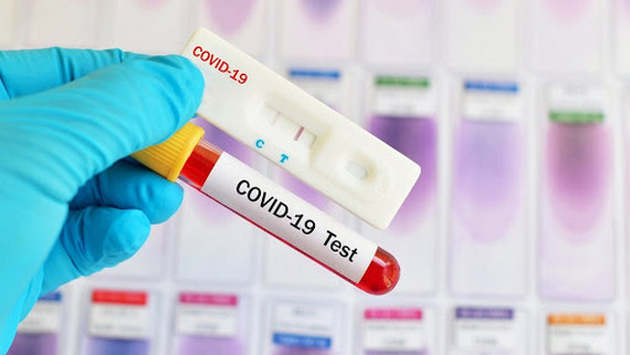 коронавірус, захворювання, статистика