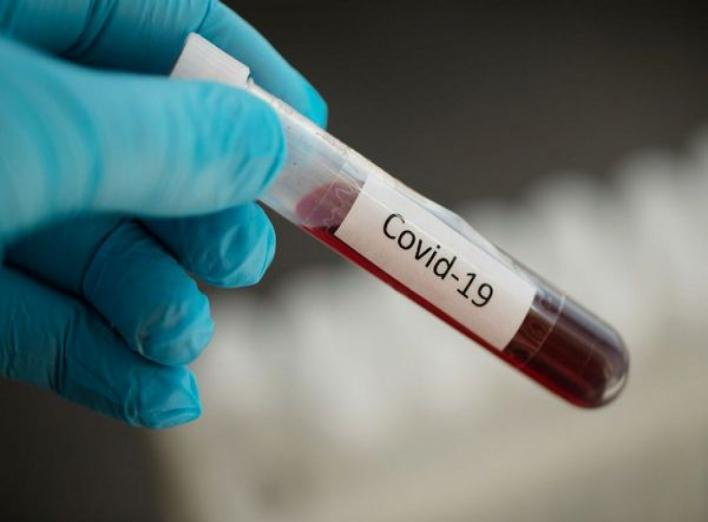 У Ніжині за добу – плюс 5 хворих на COVID-19