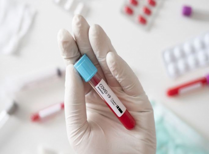 Від ускладнень, спричинених вірусом COVID-19, помер 52-річний ніжинець