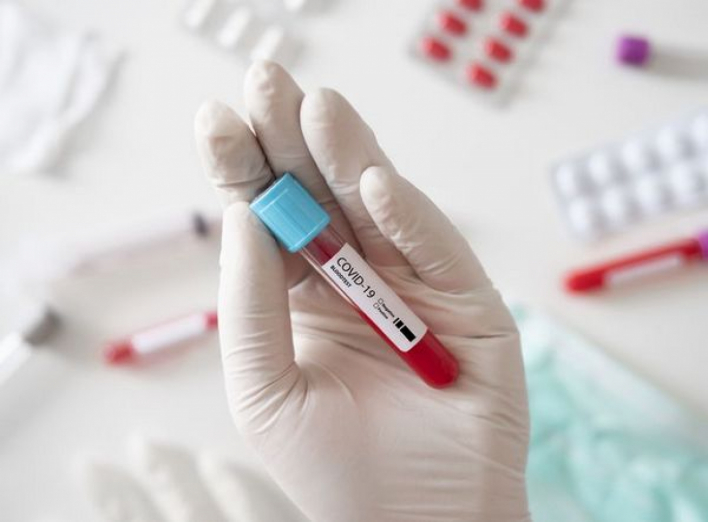 Із початку року в Ніжині – 1264 хворих на COVID-19, у районі – менше