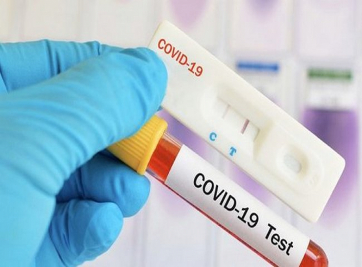 За минулу добу в Ніжині +98 хворих на коронавірус