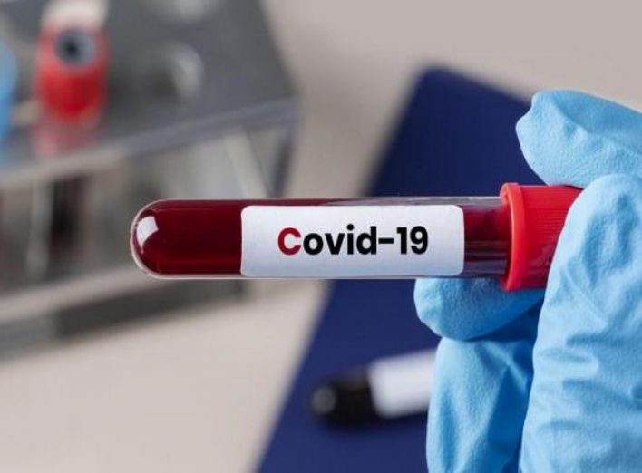 Ніжинщина: найбільше хворих на COVID-19 у Лосинівці, Вертіївці та Ніжинському