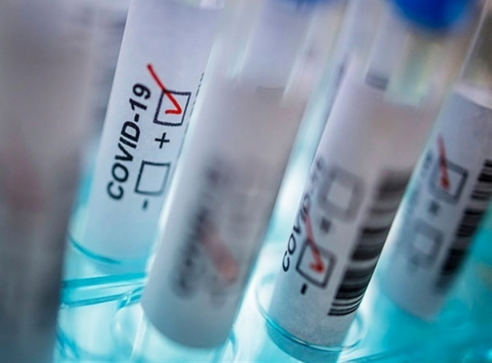 За минулу добу коронавірус виявили у 74 ніжинців