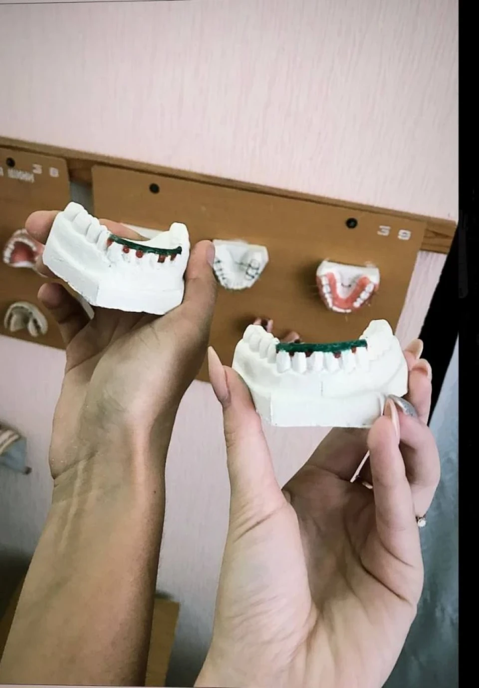 Лікувати зуби потрібно вчасно: інтерв'ю з ніжинською стоматологинею Анною Волинкою фото №7
