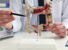 Гастроентеролог в Ужгороді — діагностика та лікування захворювань ШКТ