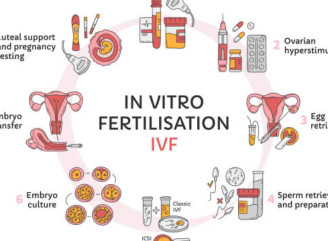 Лечение бесплодия: от медикаментозной терапии до ЭКО