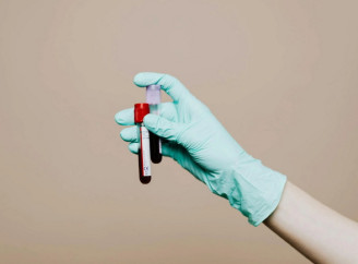 Навіщо лікар призначає аналіз на ШОЕ?