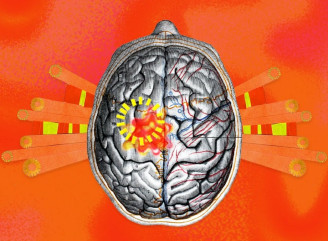 Жара б'є по мозку: спека провокує інсульти, деменцію та загострення хвороб — BBC