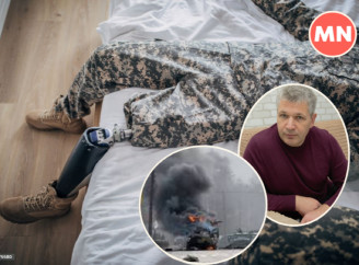 Повернення сина з війни без ноги: як впоратися з болем