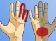7 хвороб, про які попереджають руки