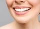 Що варто знати про відбілювання зубів?